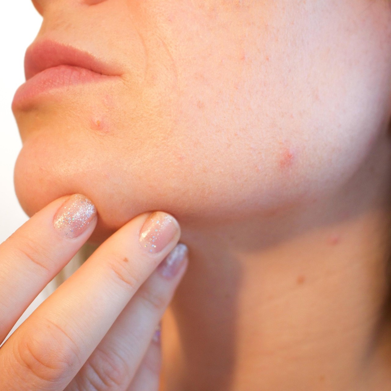 Skincare